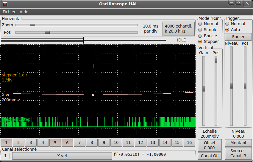 images/halscope-11_fr.png